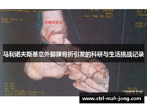 马利诺夫斯基意外脚踝骨折引发的科研与生活挑战记录